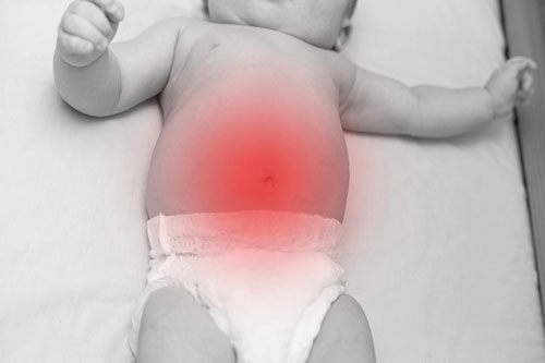 У ребенка болит живот: почему и что делать? | 1ДМЦ